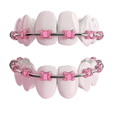 Исправление прикуса